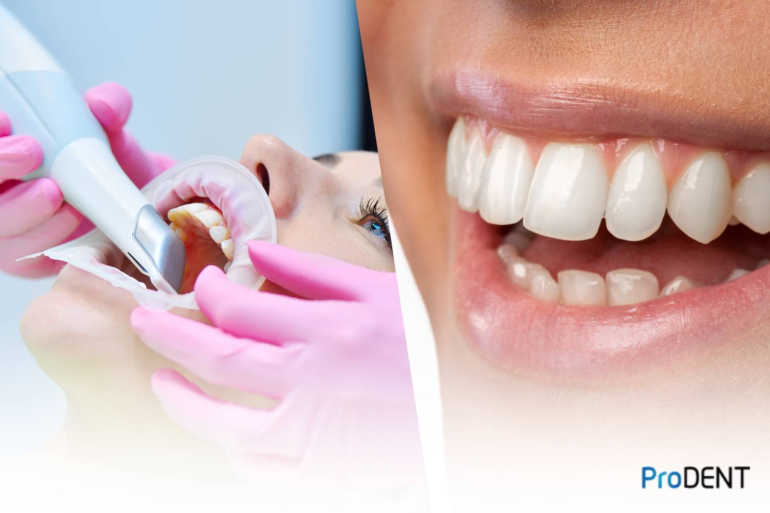 dental photographs