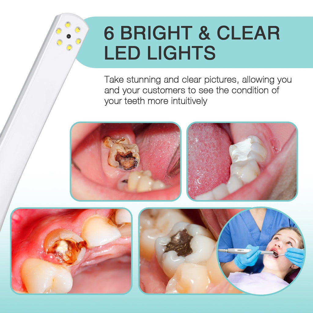 Cámara intraoral dental ProDENT PD750