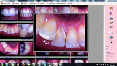 ProDENT Dental Intraoral Camera PD750