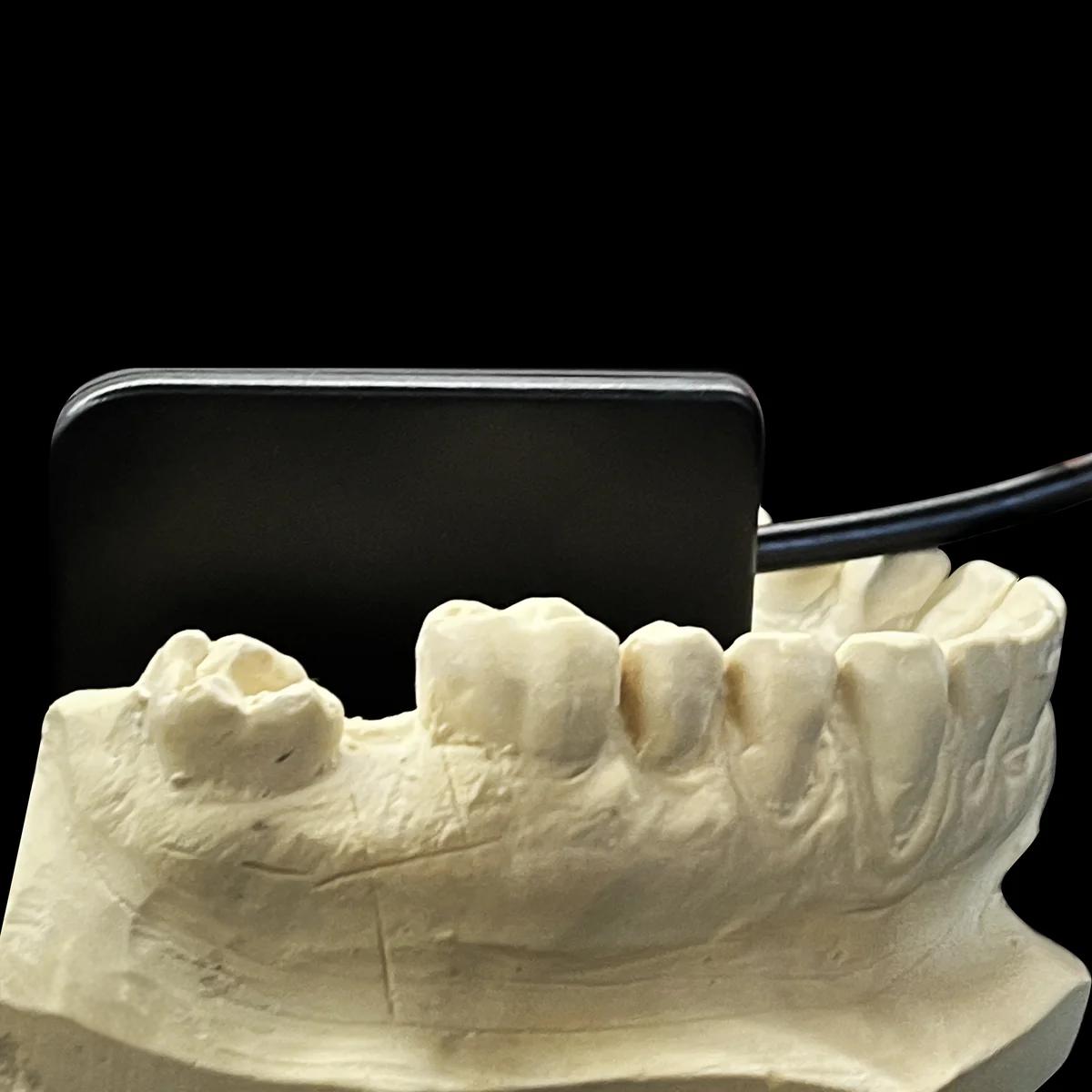 ProDENT Digital Dental X-Ray Sensor