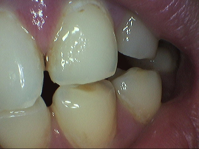 ProDENT Intraoral Camera Trade-In Program