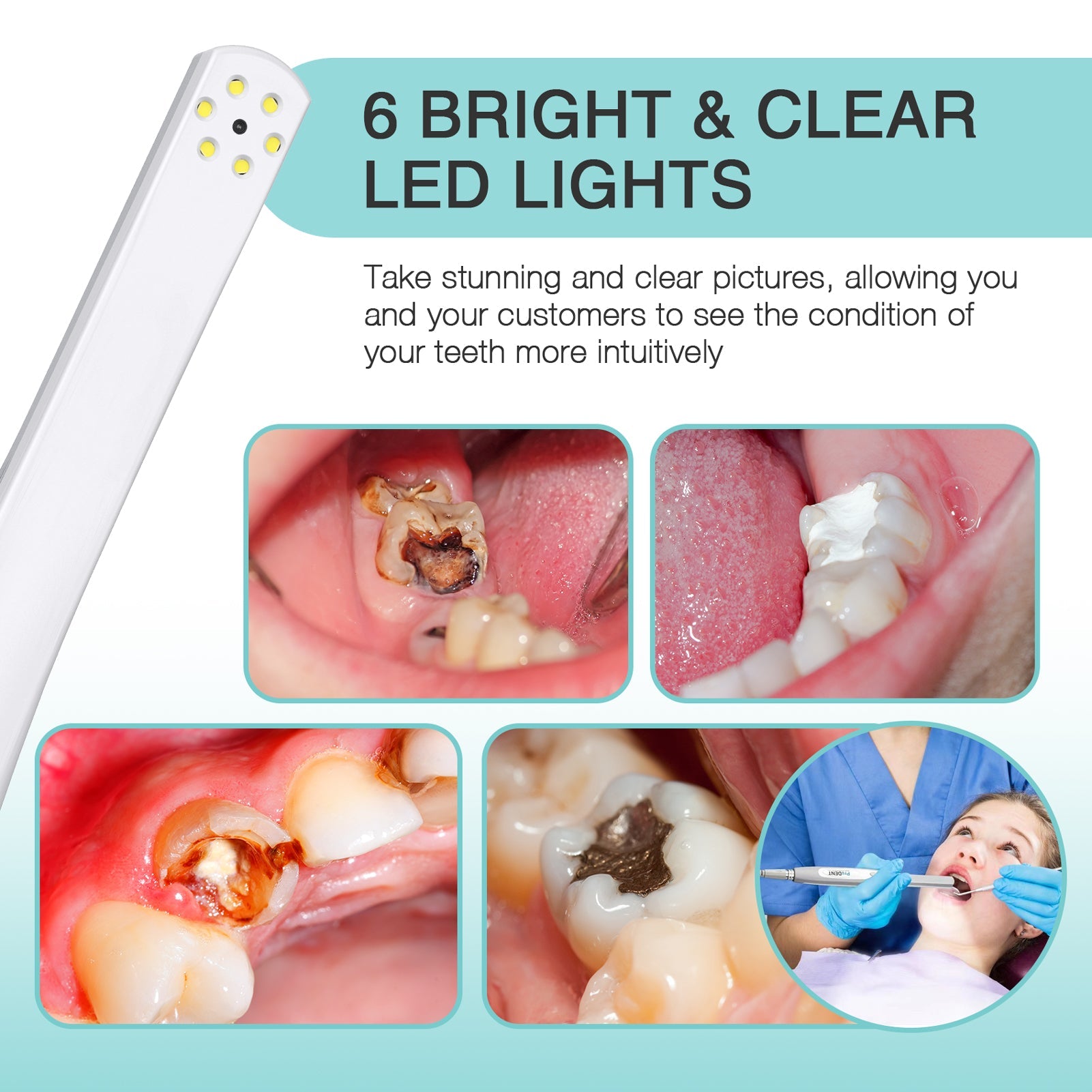 ProDENT Dental Intraoral Camera PD750