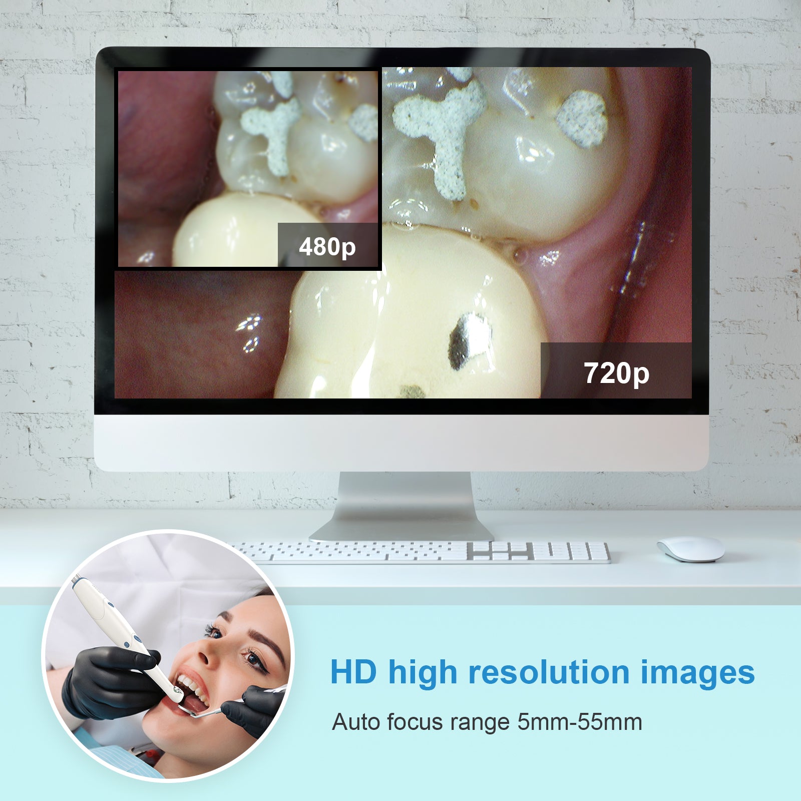 Cámara intraoral ProDENT HD PD720