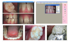 ProDENT Dental Intraoral Camera PD740