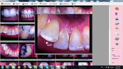 ProDENT Dental Intraoral Camera PD740