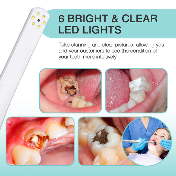 ProDENT Dental Intraoral Camera USB PD740 Blue ProDENT Shop